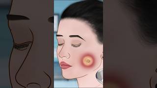 ASMR Dimple piercing infection treatment P2asmr animation satisfying trending shorts [upl. by Naivart45]