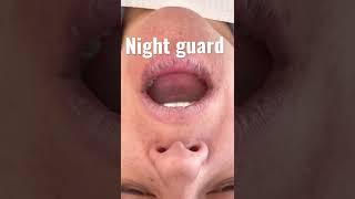 Night Guard for Bruxism Teeth Grinding and Clenching [upl. by Leifeste]