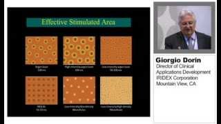 How To Determine MicroPulse Laser Parameters for SubVisibleThreshold Treatments [upl. by Angid]