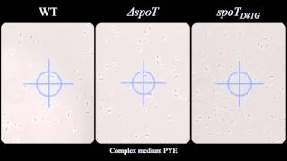 Phosphotransferasedependent accumulation of pppGpp in response to glutamine deprivation [upl. by Guendolen]