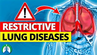 Top 13 Restrictive Lung Diseases to Know  Listed and Explained [upl. by Unni]