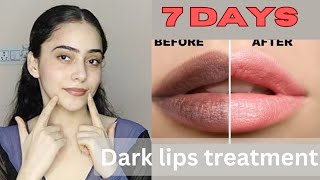 Darker lips treatment in just 7 days 🌸  say bye bye to pigmented lips 🤗  Manpreet Kaur youtube [upl. by Sutsuj34]