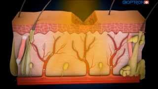 Mechanism of action phototherapy [upl. by Yenial]