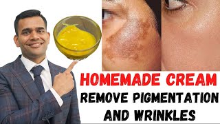 ONE SOLUTIONS FOR ALL SKIN PROBLEMS Cream To Remove Pigmentation And Wrinkles DrVivek Joshi [upl. by Marashio]