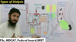 hemodialysis and peritoneal dialysis  types of dialysis [upl. by Lunneta880]