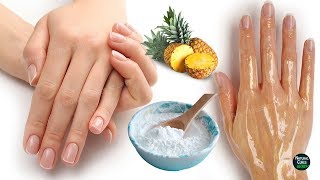 How To Remove Wrinkles From Hands Naturally in 2 Days [upl. by Ayom]