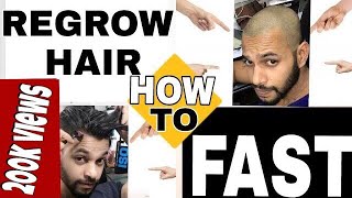 HOW TO REGROW HAIR FASTER IN JUST 350RS  STOP HAIR FALL  HINDI [upl. by Ruenhs]