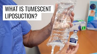 What is Tumescent Liposuction  Houston Lipo Center [upl. by Yssak]