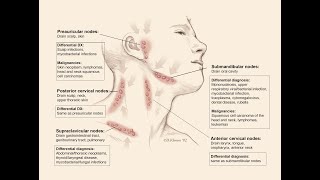 lymphadenopathy by Prof Dr Galal Abouelnagah [upl. by Eenimod362]