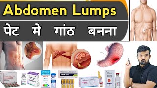 Abdomen Lumps  पेट में गांठ बनना  Medicine  Treatment  Pharmacy  Hospital  Doctor  Nursing [upl. by Brecher]