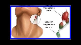 L’inflammation des ganglions lymphatiques  quelle en est la cause [upl. by Barren954]