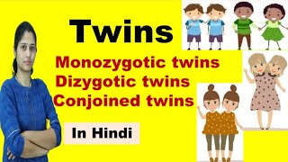 Twins  Types of Twins  Monozygotic Twins amp Dizygotic Twins  in Hindi [upl. by Ecirehc]