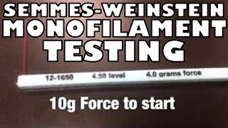 How to Perform the Semmes Weinstein Monofilament Test  Ohio University  Anatomy [upl. by Bobette]