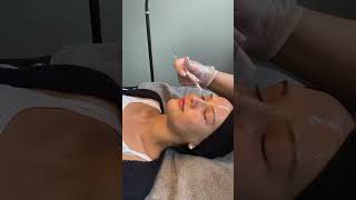 FruchtsäurepeelingMit Liebe zum Detail Kosmetiksalon Berlin ⚡️ shortsvideo skincare fruchtsäure [upl. by Eolanda881]