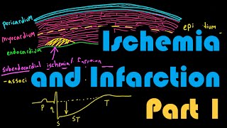 Ischemia Infarction and the Waveforms Q through U Part 1 How to Read an EKG Curriculum [upl. by Zach]