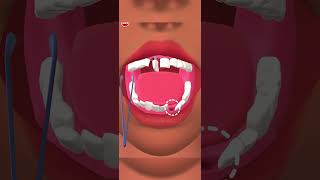 fixing new teeth 🦷 gaming asmr [upl. by Ahtanamas]