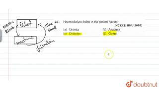 Haemodialysis helps in the patient having [upl. by Lorelei]