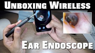 Unboxing Wireless Ear Endoscope  The Real Deal [upl. by Abihsot838]