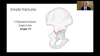 Kasr Al Ainy Postgraduate Orthopaedic Review Course  Acetabular Fractures Principles of Management [upl. by Saberio336]