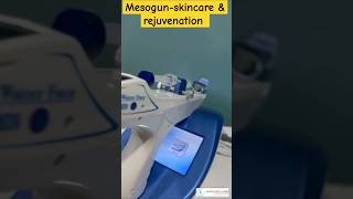 Mesogun mesotherapy machinerejuvenation [upl. by Ayimat]