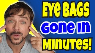 3 QUICK Under Eye Bag Fixes Dark Circles Too  Chris Gibson [upl. by Atiuqes]