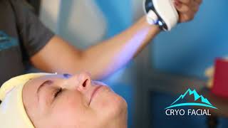 Cryo facial benefits [upl. by Mildrid]