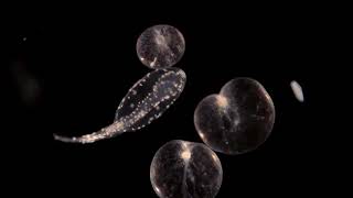 The world of tiny microscopic fish larvae from the North Sea [upl. by Goraud801]