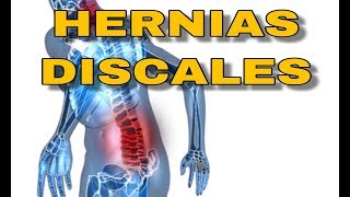 COMO MEJORAR SIN CIRUGIA  hernias discales sintomas recuperacion estiramientos hernia discal [upl. by Hoffmann]