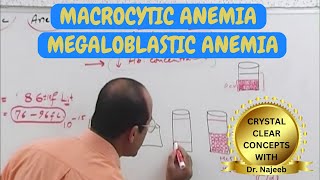 Macrocytic Anemia  Megaloblastic Anemia 🩺 [upl. by Kilbride]