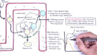 Epstein Barr Virus and Infectious Mononucleosis pathophysiology investigations and treatment [upl. by Trow256]