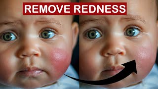 Remove Red Patches from Skin in Photoshop in 1 Minute [upl. by Chelsey]