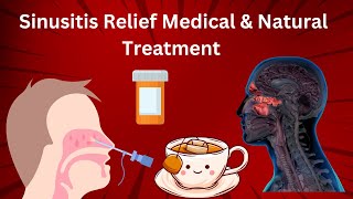 Sinusitis Relief Medical amp Natural Treatment [upl. by Eada939]