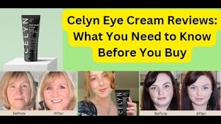 Celyn Eye Cream Reviews what you need to Know [upl. by Toffey]