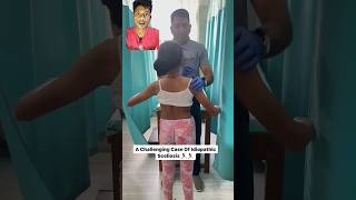 Scoliosis treatment shortsyt short shortfeedtrend [upl. by Amara]