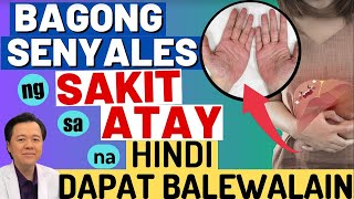 Bagong Senyales ng Sakit sa Atay na Hindi Dapat Balewalain  By Doc Willie Ong [upl. by Ttegdirb682]