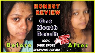 Best Dark Spots removing cream100 Honest reviewFLUCORT H oilment [upl. by Lebasiairam]