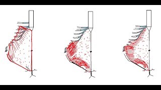 Inguinal canal 1  introduction  DR SAMEH GHAZY [upl. by Cocks]