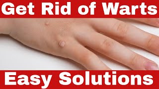 How to Get Rid of Warts Fast  Simple Proven Remedies [upl. by Solorac141]