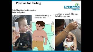 Button Gastrostomy Feeding [upl. by Negaem]