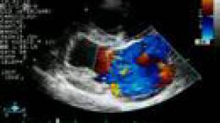 Mitral Regurgitation  Color Doppler Echocardiogram  Dog [upl. by Anahsed241]