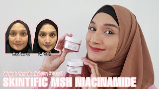 Perubahan dalam Seminggu Pakai Skintific MSH Niacinamide [upl. by Lexa2]