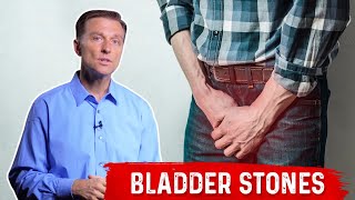 Bladder Stones Causes Symptoms amp Remedies  Dr Berg [upl. by Shulins]