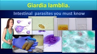 Giardia lambliaLife cycleStructureLabdiagnosisGiardiasisClear overview [upl. by Anam]