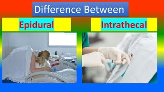 Difference between Epidural and Intrathecal [upl. by Rozanna939]