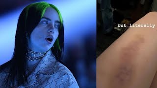 🎸 Billie Eilish takes nasty fall during New York concert [upl. by Ahsetel]