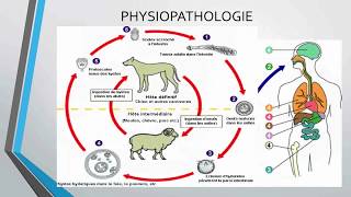 Kyste Hydatique Pulmonaire Diagnostic et Traitement [upl. by Assirralc]