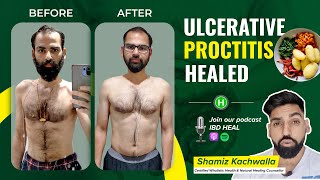 Anand gets rid of Ulcerative Proctitis  Med free [upl. by Nitnilc]