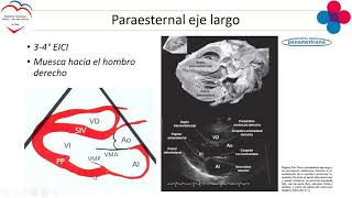 MODULO ECOCARDIOGRAFIA  INTRODUCCION  SYULIDORE [upl. by Lory]