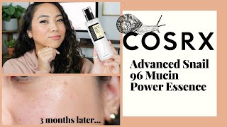 COSRX SNAIL MUCIN ESSENCE MUST WATCH BEFORE YOU BUY  REVIEW  DEMO ON COMBINATION SKIN [upl. by Nadabb285]