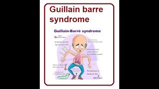 Guillain Barré Syndrome  2024 [upl. by Marlin512]